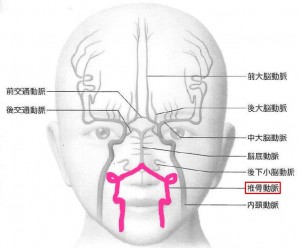 脳血管１VA