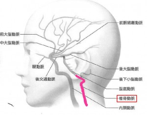 脳血管２VA